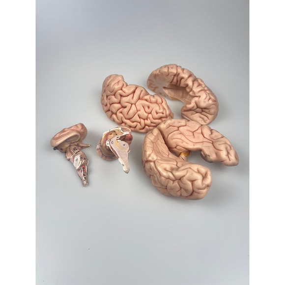 Vintage Somso Germany Anatomical Teaching Model | Human Brain | 6 Parts | Oddity - Picture 6 of 9